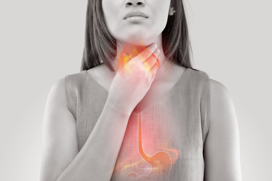 What are the Causes of Acid Reflux? 10 Common Triggers You Should Know